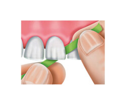 Fiber-Splint ML